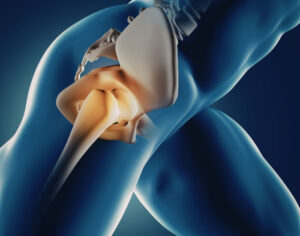 promise of genicular artery embolization knee pain