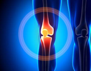 GAE knee pain innovative treatment option