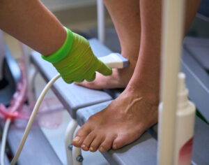 varicose veins symptoms and treatment options