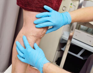 best vein specialist near me criteria