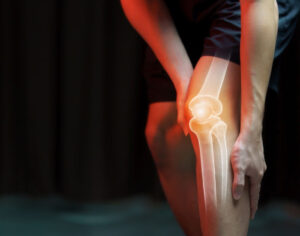 Pro-inflammatory Cytokines in OA