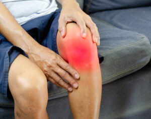 Knee Pain from Varicose Veins