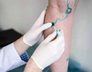 Evening vein specialist