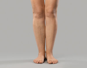 heavy feeling in the legs