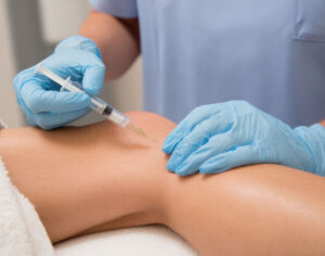 Best Vein Specialist Near Me in Houston | Expert Vein Care & Treatment Options