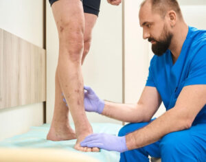 varicose vein treatment options