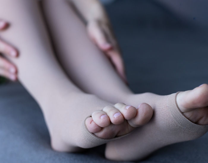 Vulvar Varicosities During Pregnancy: Symptoms and Treatment