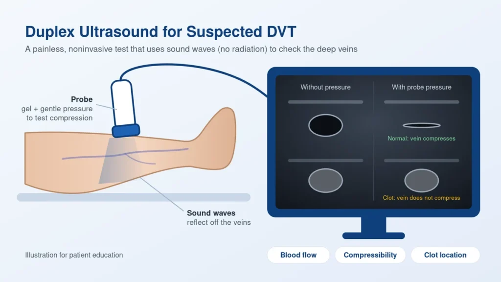 Venous duplex ultrasound examination for suspected deep vein thrombosis