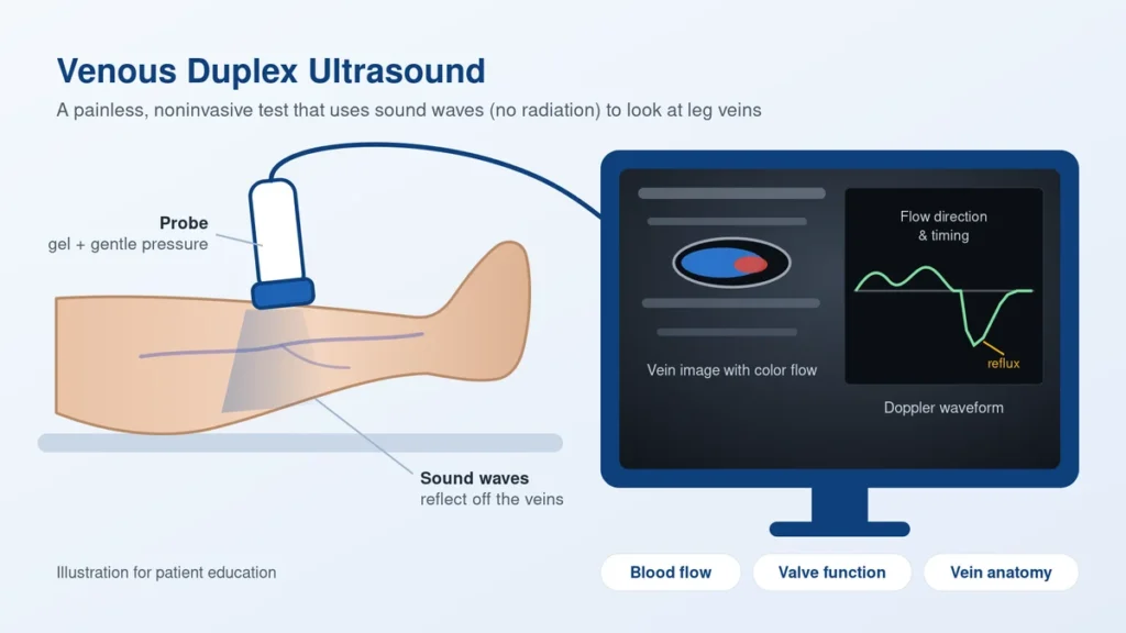 Venous ultrasound examination used to evaluate blood flow in the leg